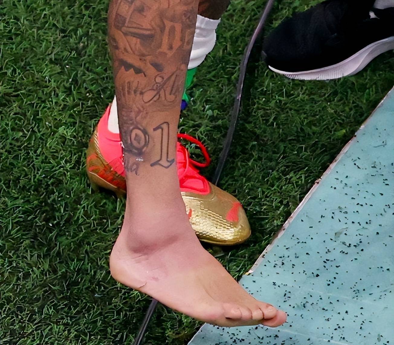 奥尔德雷尔尔德斯受伤，伤停三周的简单介绍